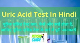 Uric acid test in hindi – यूरिक एसिड टेस्ट क्या, कैसे और क्यों होता है